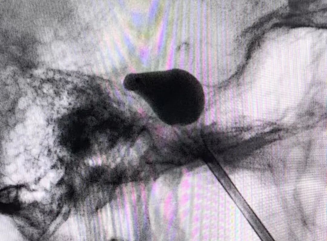 点击图片进入下一页